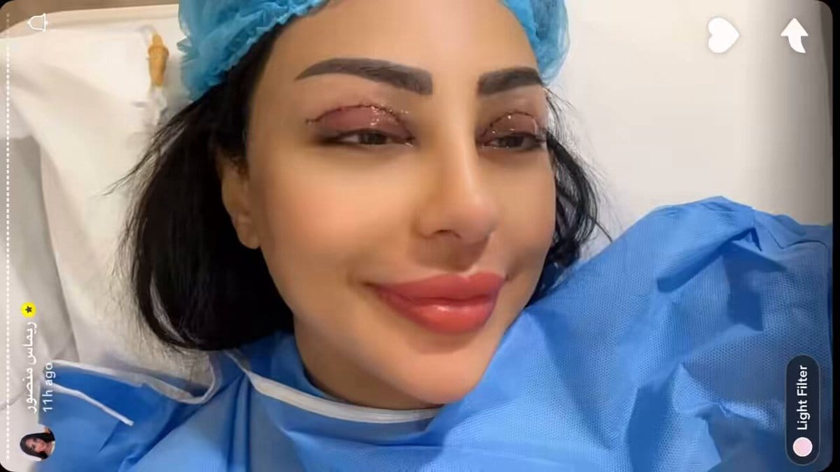 ريماس منصور تتصدر الترند بعد خضوعها لعملية تجميل